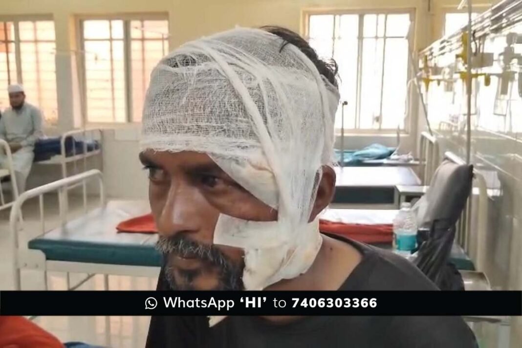 Sidlaghatta karaga Attack Injury