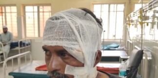 Sidlaghatta karaga Attack Injury